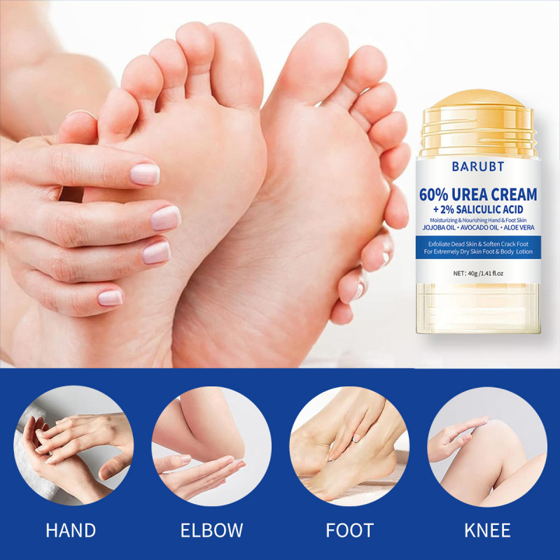 尿素フット＆ハンドクリーム（サリチル酸2％配合）、乾燥してひ - Urea Foot Cream のレビューと価格
